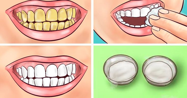 GUARANTEED! WHITEN YOUR YELLOW TEETH IN LESS THAN 2 MINUTES!